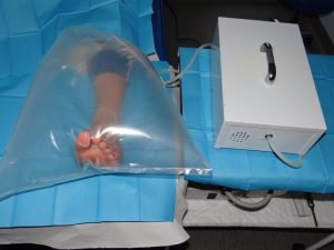 اوزون تراپی